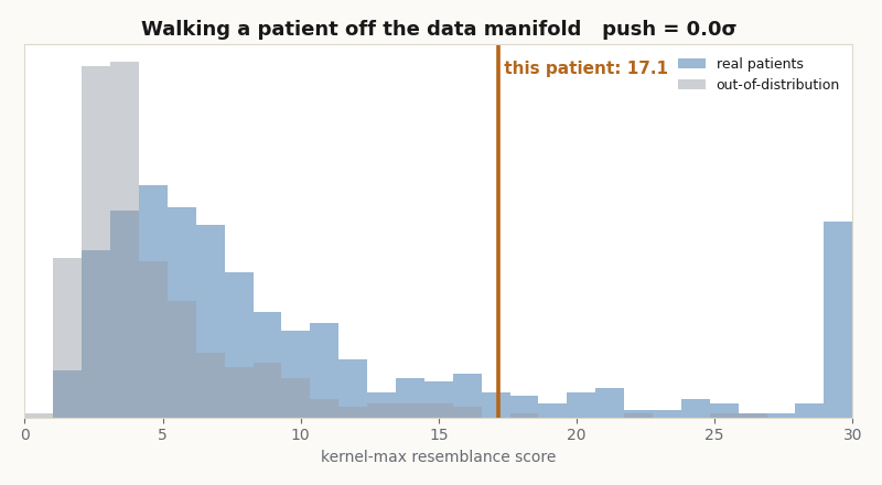 A vertical marker for one patient sweeping left across two overlaid histograms of kernel-max scores for real and out-of-distribution patients as the patient is pushed off distribution